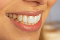 Teeth Whitening Sacramento cosmetic dentistry